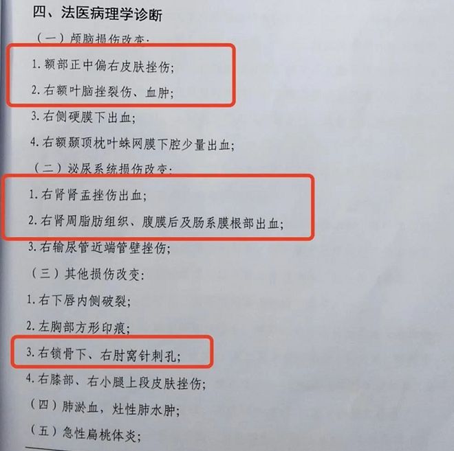 痛心！18岁学生睡觉时从宿舍床铺坠亡危险的“上下铺”再惹争议(图2)