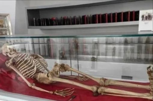 湖南女巨人：14岁身高超过姚明18岁意外猝死去世41年未下葬(图1)