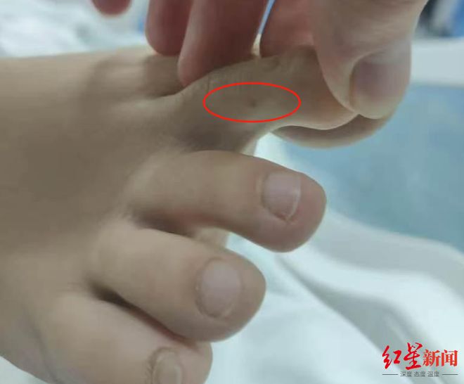 官方介入调查“27岁女子三亚旅游疑被不明物咬伤身亡”事件 家属：未来有考虑尸检(图1)