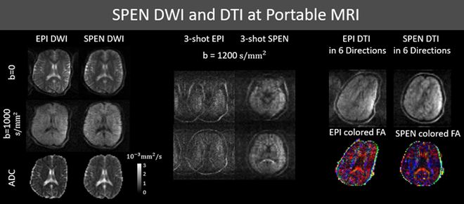 邱月淇全球唯一获奖者(图5)